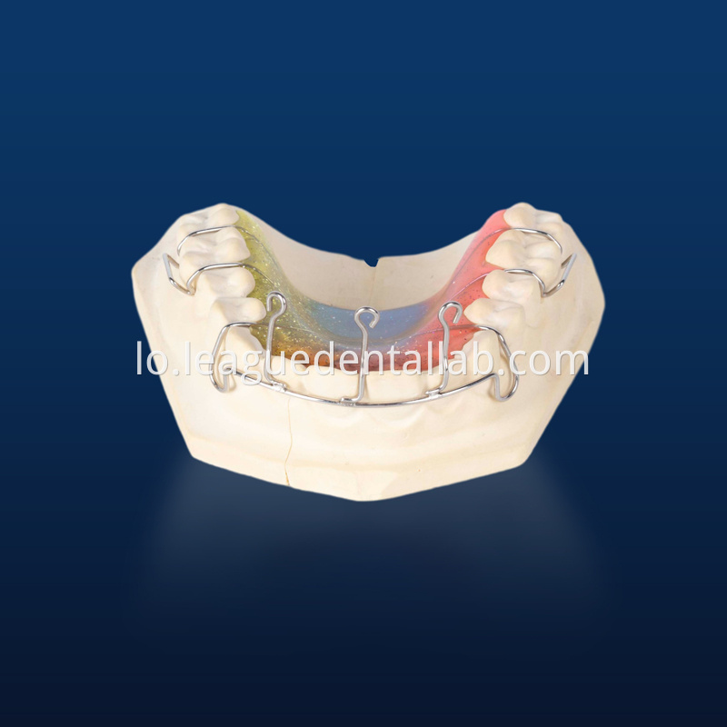 Retainer Space, Retainer ທີ່ກໍານົດເວລາ, Retainer Begg, Retainer Retainer, Hawley Retainer Space retainer,Lingual fixed retainer,Begg retainer,Invisible retainer,Hawley Retainer